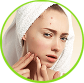 Acne - Ayurvedic remedies for Skin Care
